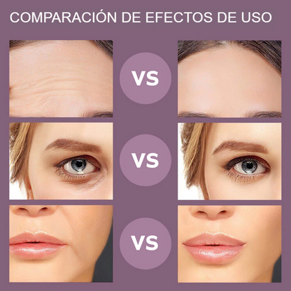 SkinGlow - Dispositivo de Rejuvenecimiento Facial con Microcorriente y Estimulación Muscular