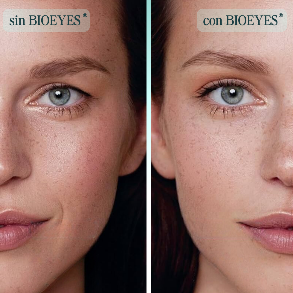 BIOEYES® KIT LEVANTA PÁRPADOS 12O UNIDADES