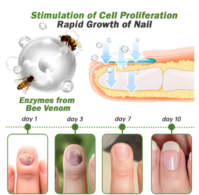 Suero para uñas con veneno de abeja-crecimiento y elimina hongos en 10 dias