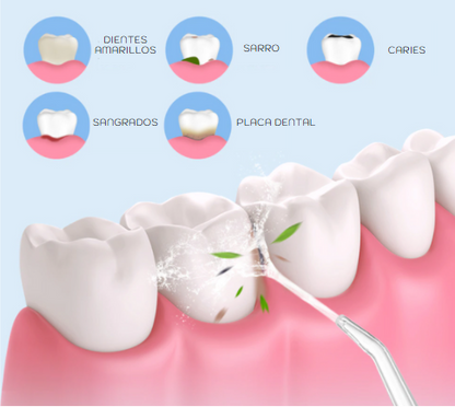 Irrigador Bucal Multifunción 🔥ESPECIAL CYBERDAYS🔥